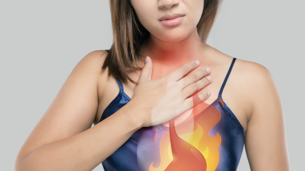 Acid Reflux