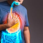 How long will acid reflux last